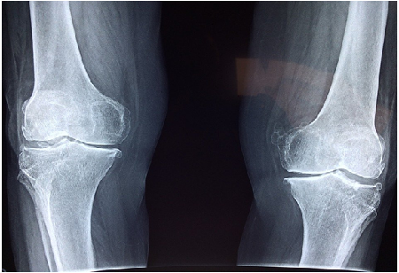 Why People Need to Take Accident Prevention More Seriously