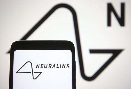 Co-founder of Neuralink Leaves Elon Musk's Firm and Makes Startling Assertions on its Security